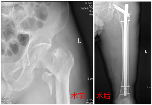 術(shù)前術(shù)后對比圖_副本.jpg