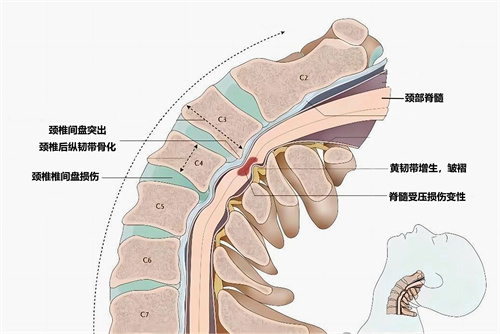 圖解.jpg